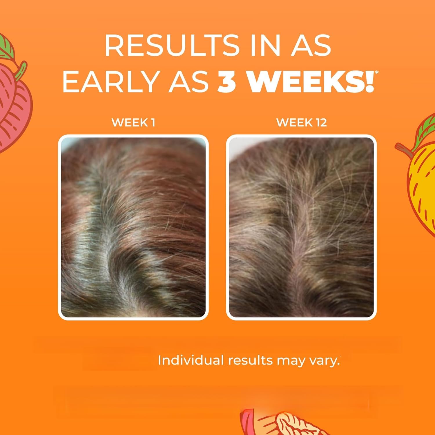 vitamine per la crescita dei capelli | Aiuta a far crescere capelli e unghie naturalmente più forti; aiuta a migliorare le condizioni della pelle