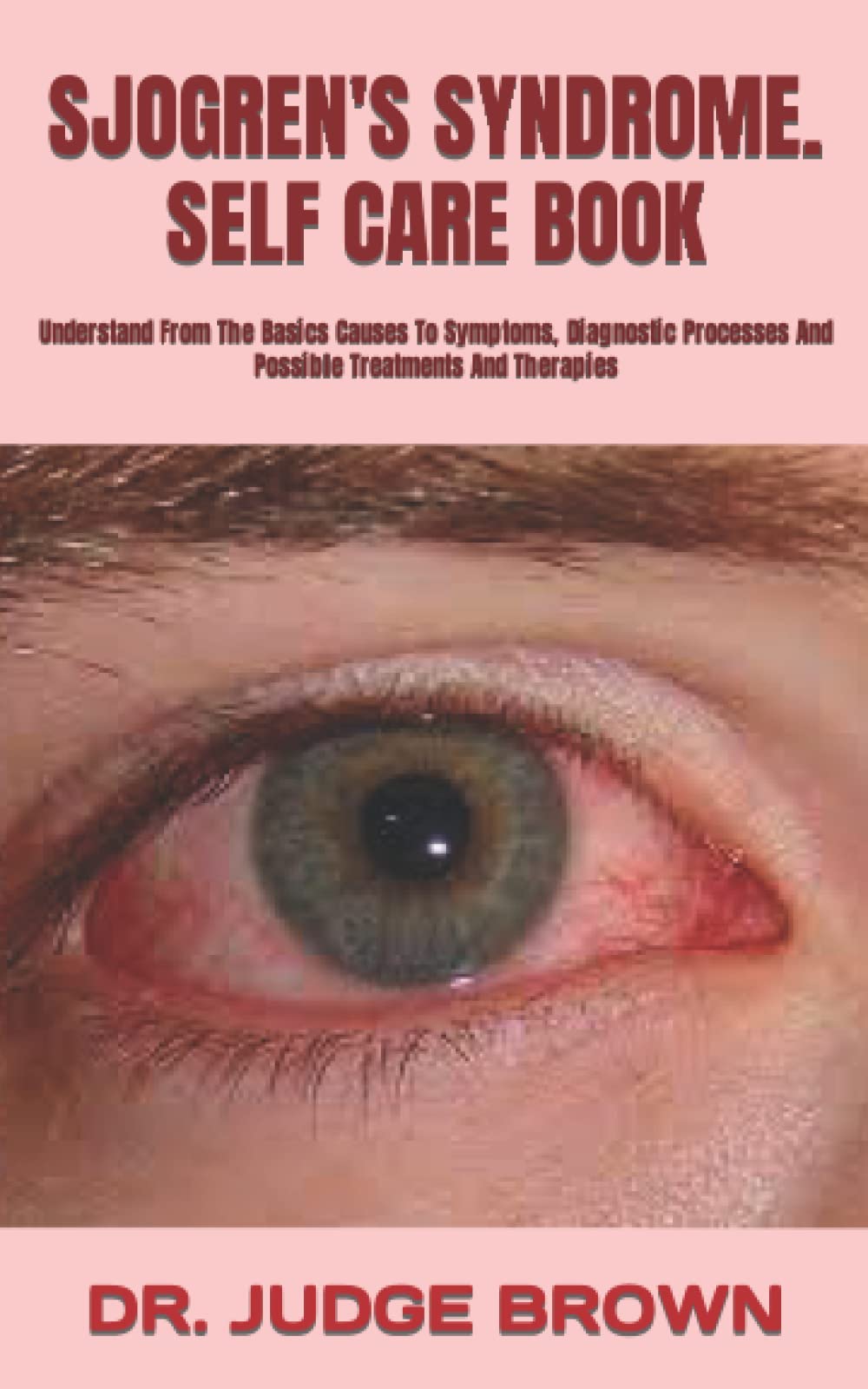SJOGREN'S SYNDROME. SELF CARE BOOK: Understand From The Basics Causes To Symptoms, Diagnostic Processes And Possible Treatments And Therapies