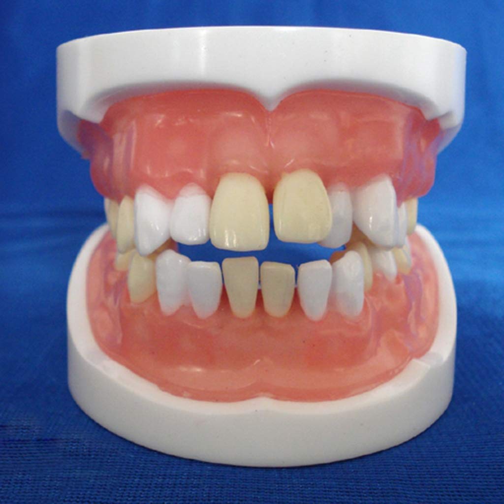 Sjdopulse Dental Teeth Anatomical Model - Teeth Oral Model - Medical Anatomical Tooth Extraction Model - For Educational Oral Human Teeth Training Model