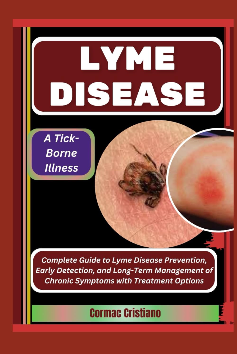 LYME DISEASE: A Tick-Borne Illness: Complete Guide to Lyme Disease Prevention, Early Detection, and Long-Term Management of Chronic Symptoms with Treatment Options