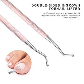 Teenitor Pedicure Tools for Feet, Toenail File and Lifters, Ingrown Toenail Removal Kit Pain Relief (Pink)