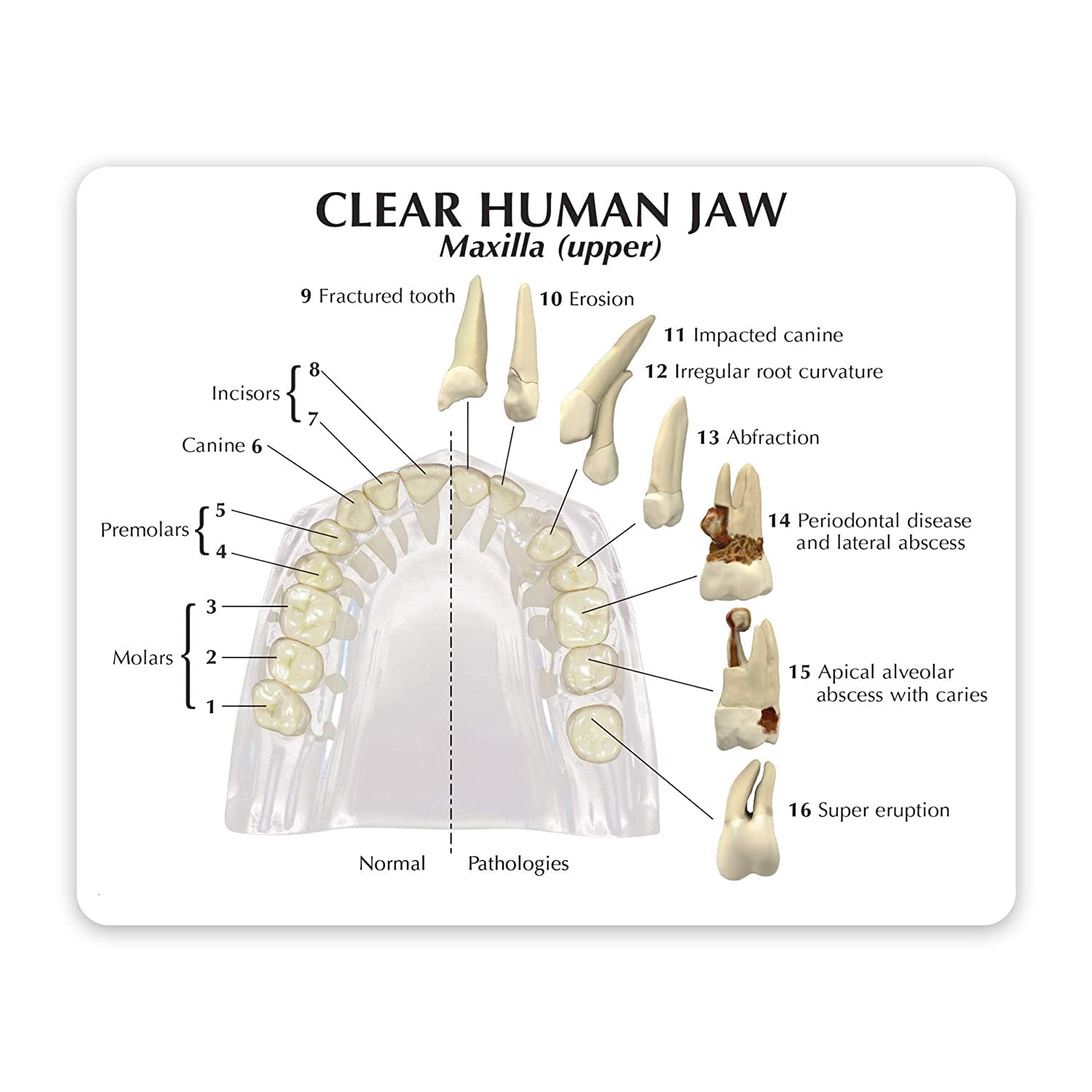 Modello anatomico dentale di mascella con denti per uso educativo, perfetto per studi dentisti e studenti di odontoiatria, replica anatomica del corpo umano