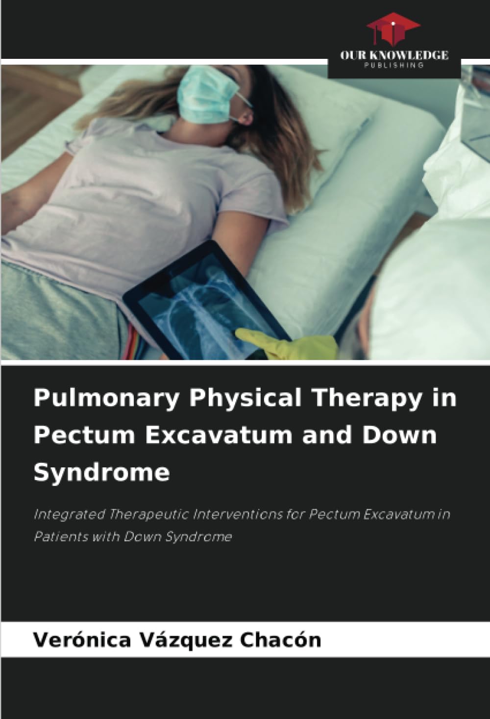 Pulmonary Physical Therapy in Pectum Excavatum and Down Syndrome: Integrated Therapeutic Interventions for Pectum Excavatum in Patients with Down Syndrome