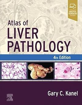 ATLAS OF LIVER PATHOLOGY WITH ACCESS CODE 4ED (HB 2024)