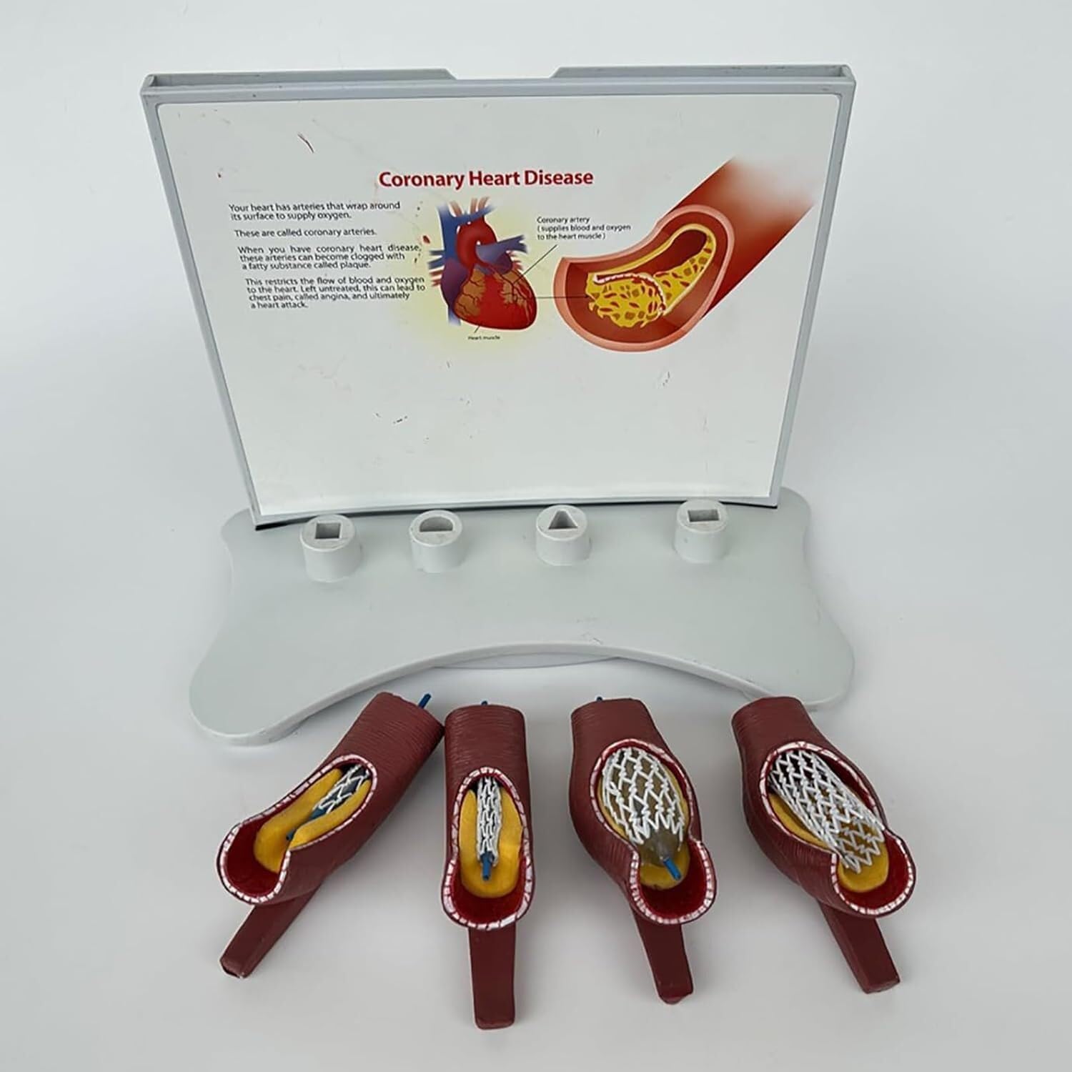 model anatomiczny, Model nauczania okluzji naczyń krwionośnych