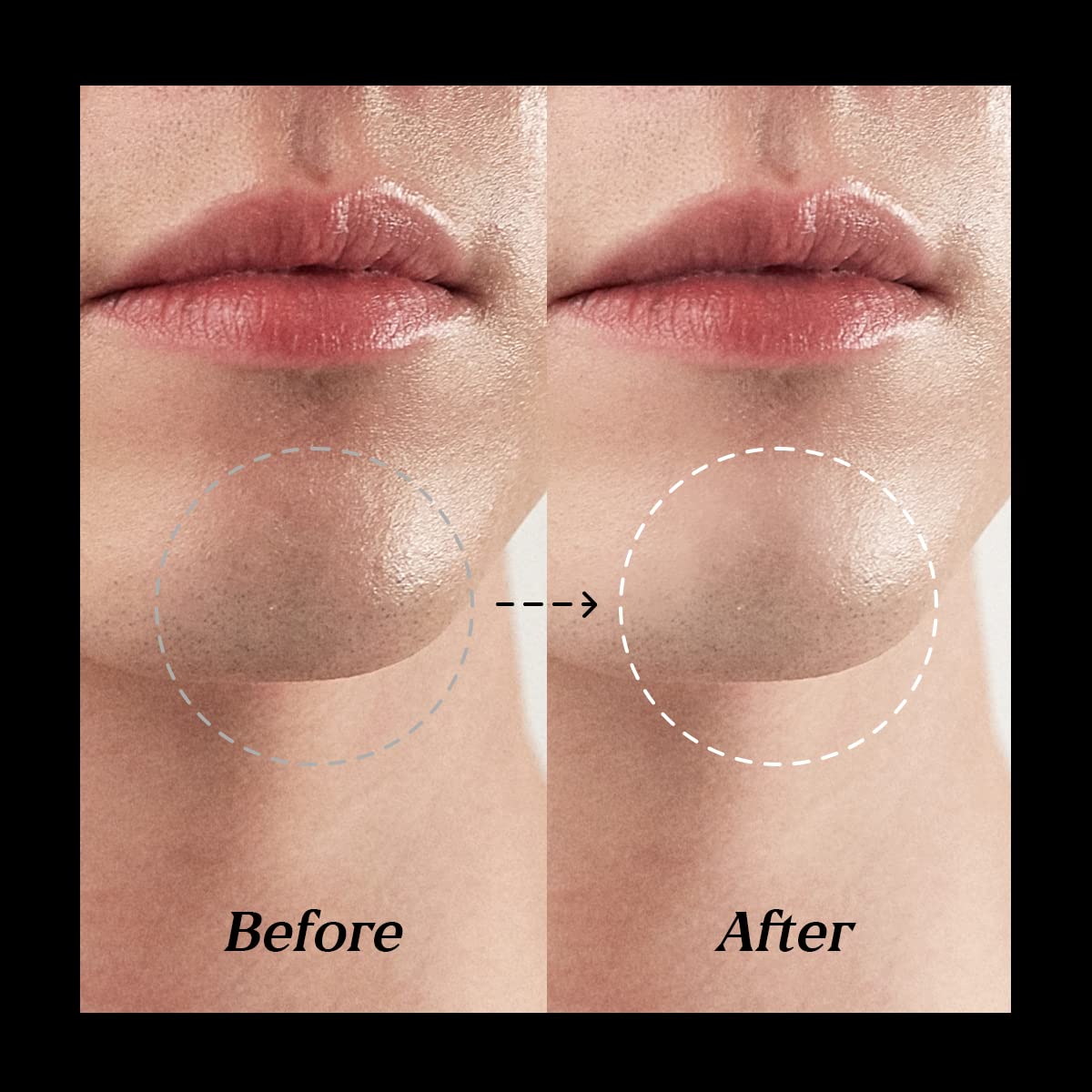 BLACK MONSTER Face Concealer Stick Acne Remover, Natural Instant Age Rewind Dark Circles Eraser Waterproof Full Coverage Under Eye Brightener Dual Sided Applicator for Men and Women (Amber Beige) : Beauty & Personal Care
