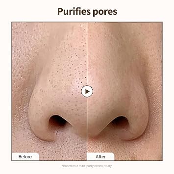 PONGDANG Real Effect Vita Toning Serum (1.01fl.oz) | Brightening Uneven Skin Tone, Refined Pores | Daily Blackheads, Pore Care with White Truffle & Niacinamide | Korean Skin Care