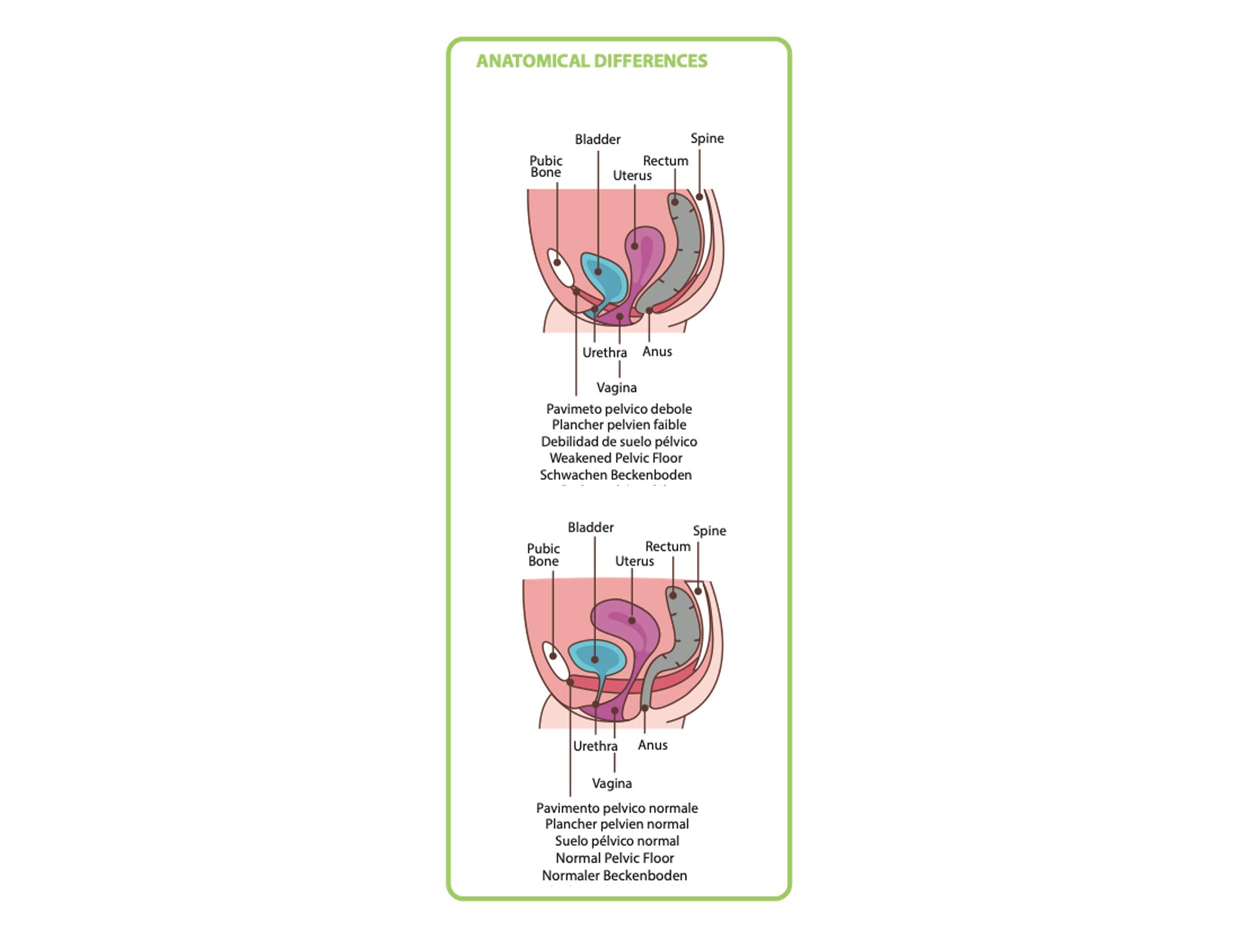 Palline di Kegel - Kit 3 Coni - Dispositivo Medico Brevettato per Ginnastica e Riabilitazione Pelvica Incontinenza urinaria post parto, disfunzioni pavimento pelvico - consigliato da Medici