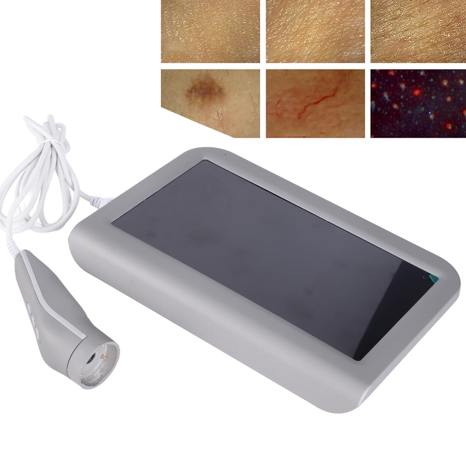 Analyseur de Cheveux de Diagnostic de Peau, Machine D'analyse de Peau 10,1 Pouces Type de Cuir Chevelu Follicule Pileux Peau Détecteur de Cheveux Analyseur Machine Numérique