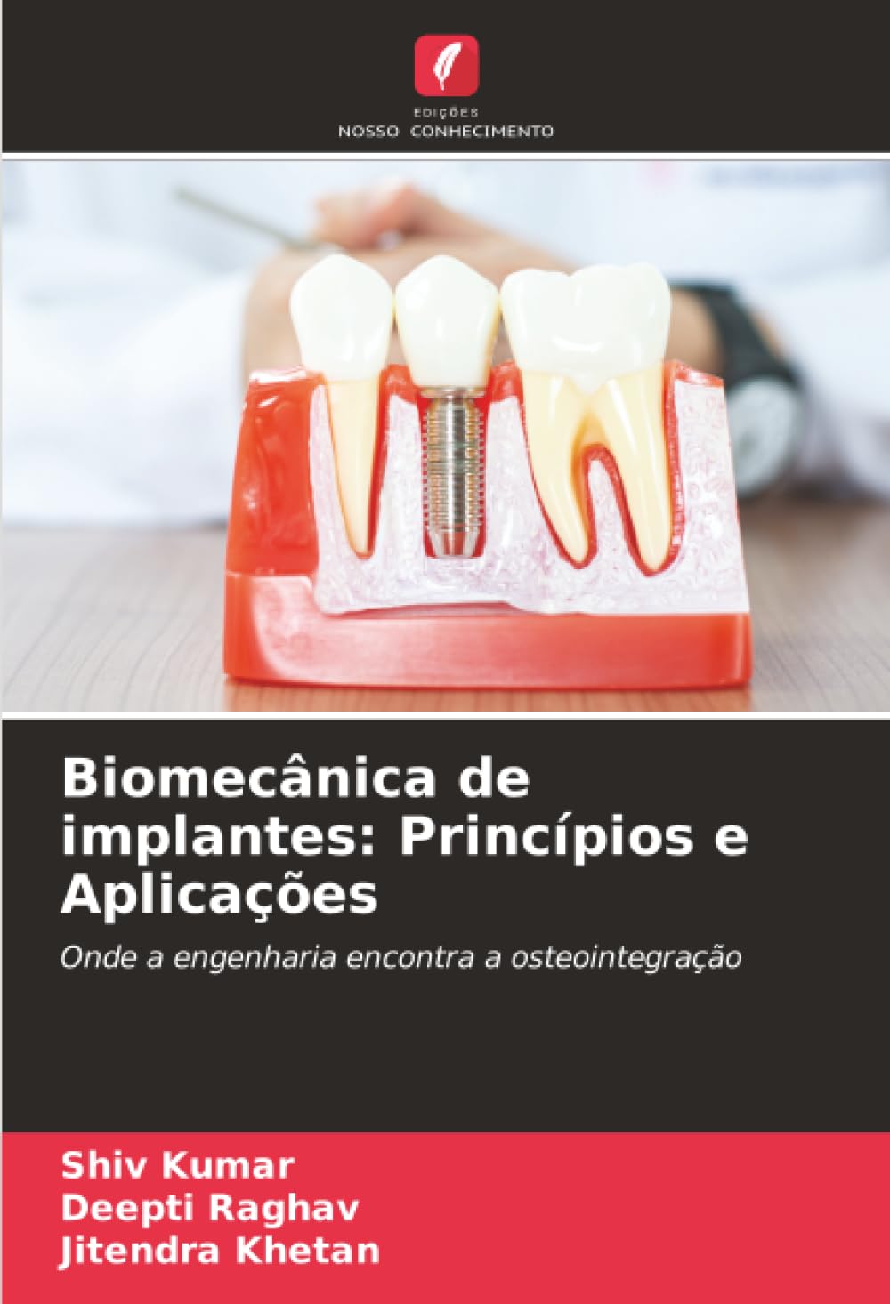 Biomecânica de implantes: Princípios e Aplicações: Onde a engenharia encontra a osteointegração