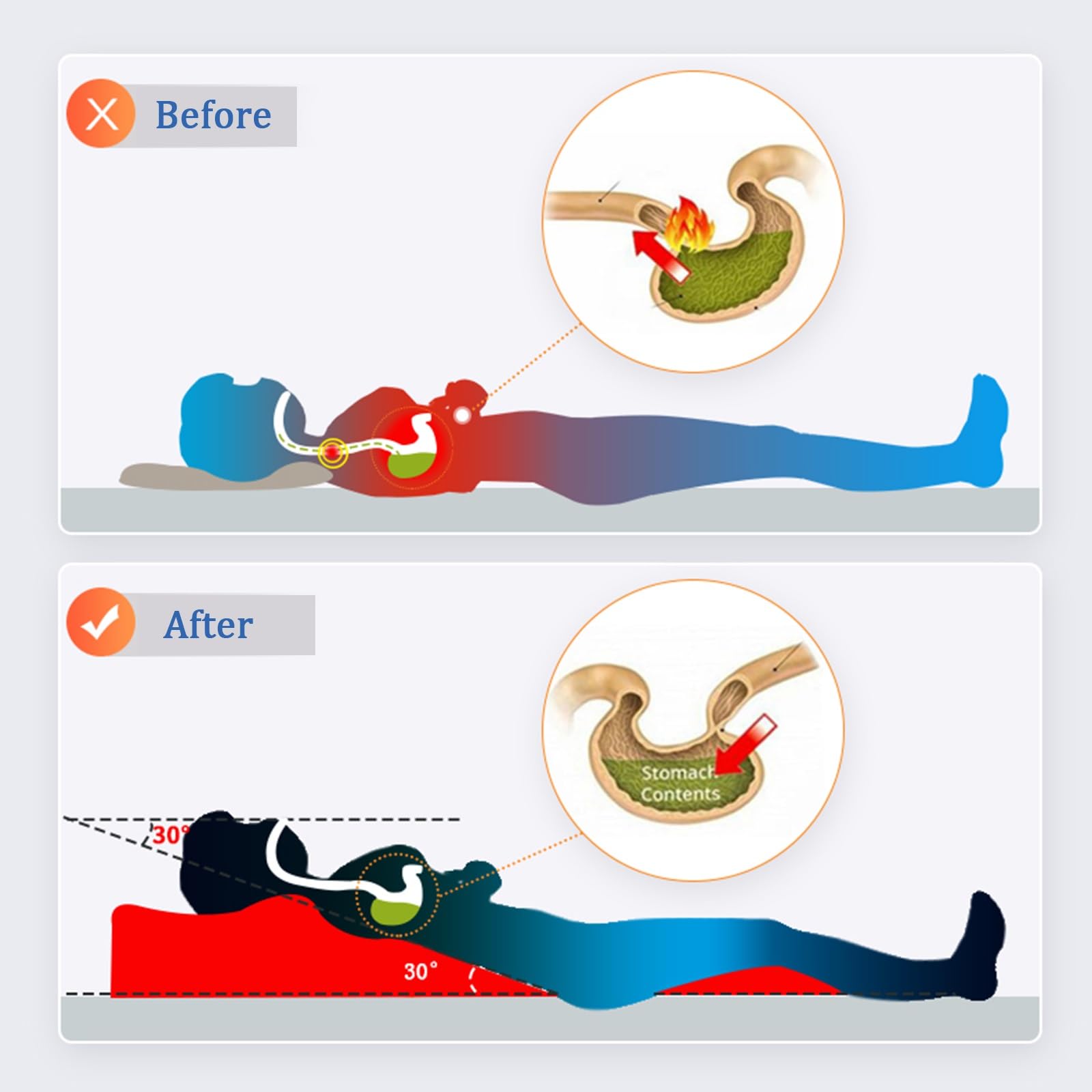 CuñA Antireflujo Adulto Almohada Elevar Colchon Almohada de cuña alargada, cuña de cama para personas mayores/embarazo/adultos para dormir de lado, cuñas de almohada de apoyo para cuello/espalda/cintu