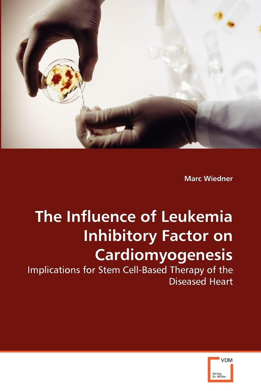 The Influence of Leukemia Inhibitory Factor on Cardiomyogenesis: Implications for Stem Cell-Based Therapy of the Diseased Heart
