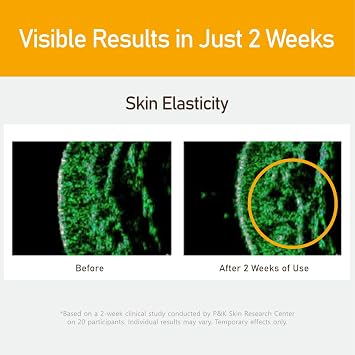 Elensilia 80% Collagen With Gold Peptides Eye Cream - Snail Secretion Filtrate + Matrixyl 3000 + Haloxyl For Wrinkles, Moisturizer - Korean Skin Care, 0.7 fl.oz (Pack of 1)