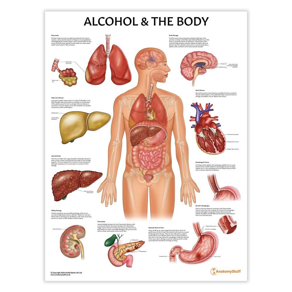 Anatomy Stuff Anatomy Alcohol And The Body Chart/Poster, 45X60cm, 18X24 Inches, Human Anatomical Poster For Education Learning And Students, Alcohol Effects On The Human Body, Pathology Poster