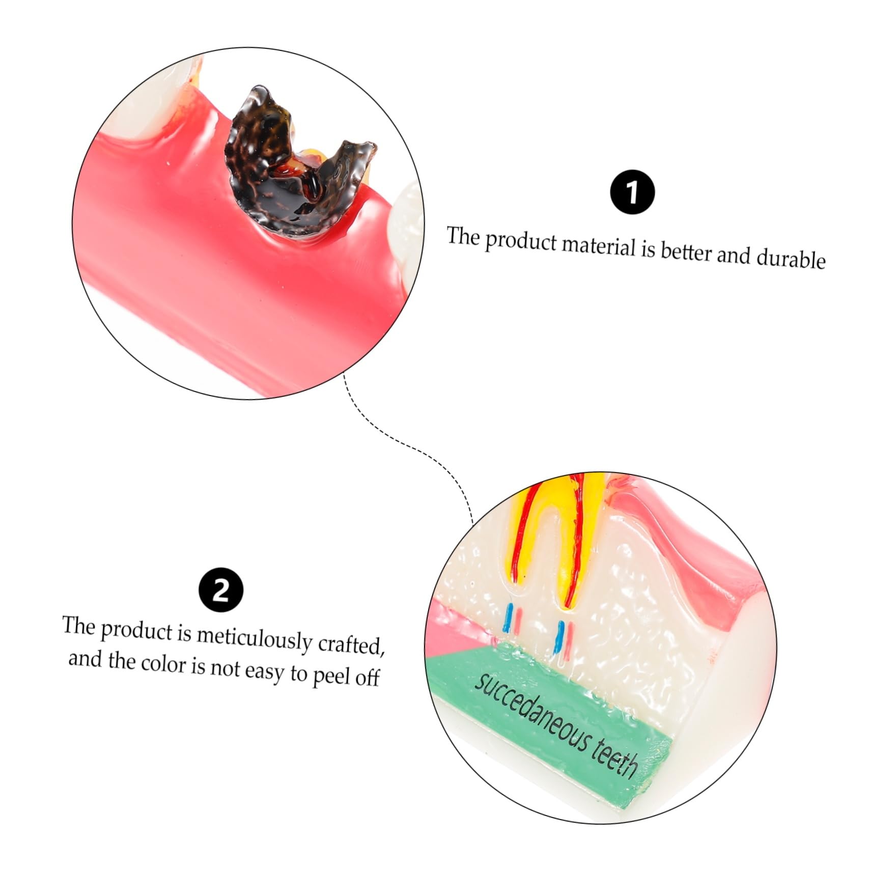 Alipis Modello Didattico di Denti Carie Resistente per Corsi Odontoiatrici, Strumento Dimostrativo per Studio e Lezioni di Igiene Orale, Modello Educativo Professionale per Studenti
