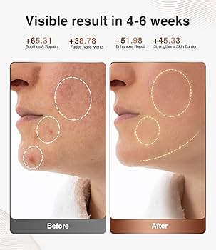 JOVS　光美容器　Mini　D937　【USED】 Amazon.com : JOVS Red Light Therapy Mask for Face, LED Face