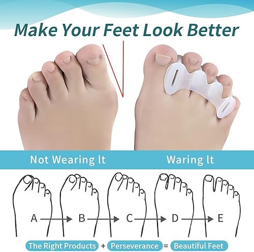 Miniatura 5 de Corrector de juanetes para mujer, alisador de dedos grandes, espaciadores de dedos para pies, corrector de dedo martillo para alivio de juanetes,