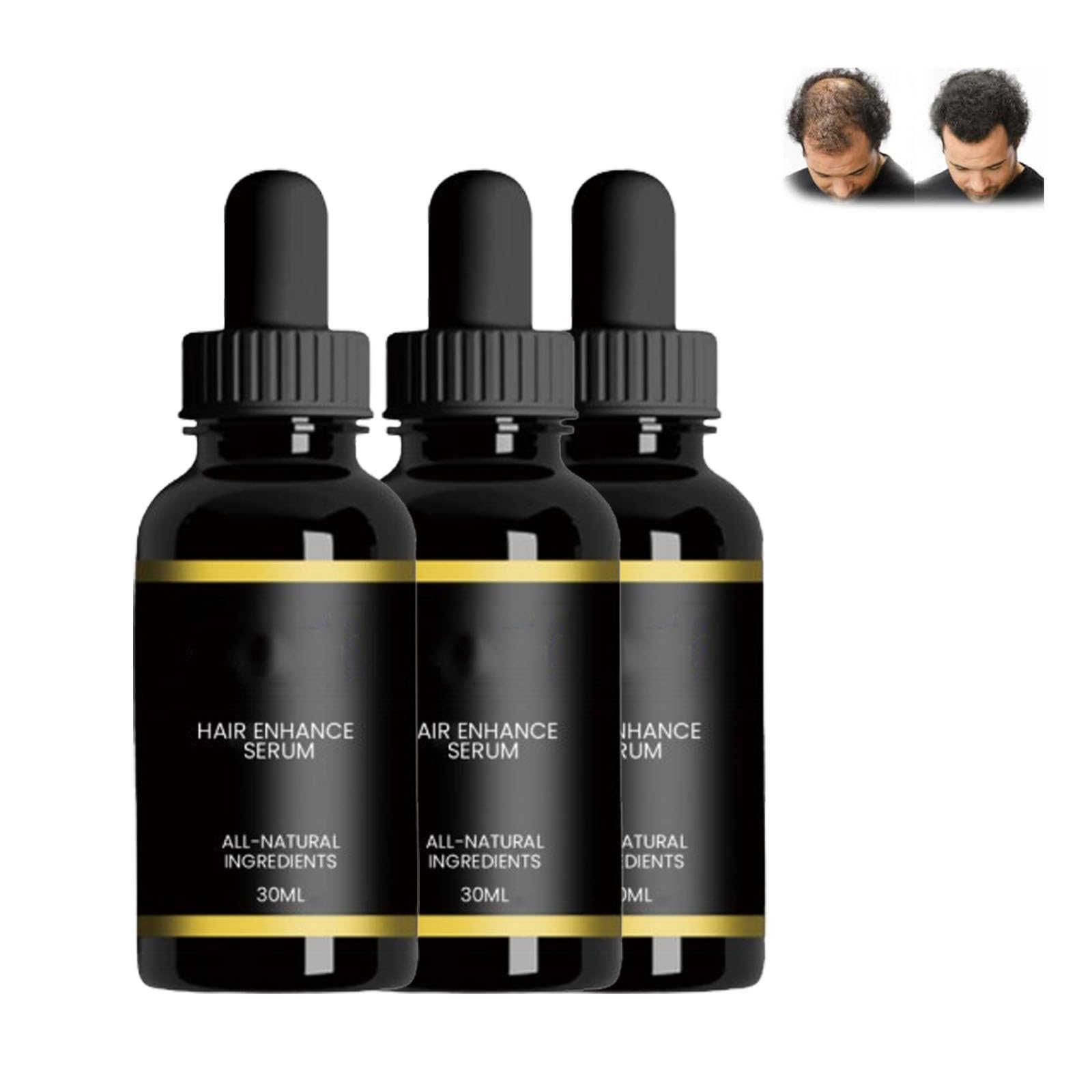 GIONAR Folix22 Hair Growth System, 3pcs (Hair Growth Serum, Oil & Formula) for Men and Women, Unisex-Adults, Clear/Transparent, Unscented, 30ml Each