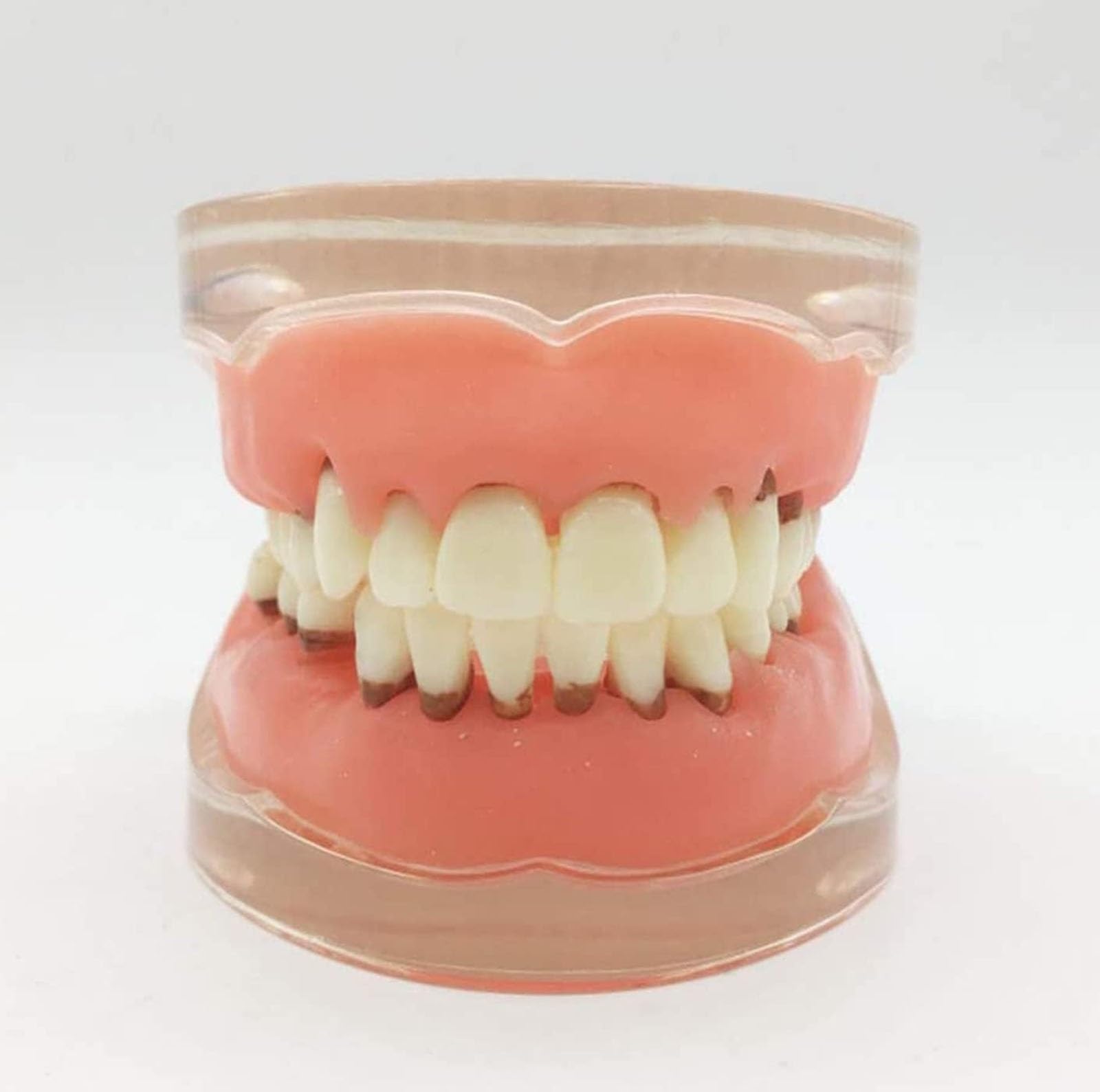 Modèle de dents pour maladies parodontales pour l'éducation, modèle d'enseignement anatomique avec gencives molles et dents amovibles pour démonstrations et entraînement dentaire