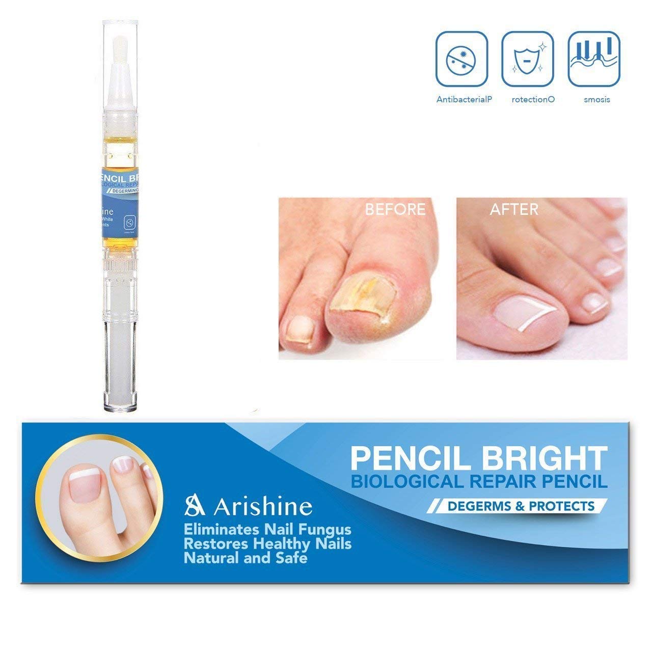 Buy Nail Fungus , Fungus Stop, Maximum Strength AntiFungal Nail