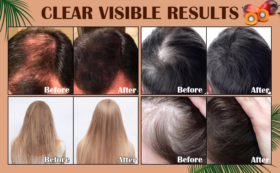 Miniatura 3 de Aceite de batana para el crecimiento del cabello con romero, ingredientes orgánicos y naturales para mujeres y hombres  nutre, repara las puntas