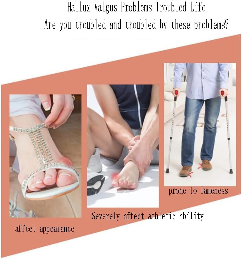 DEAVER Toe Separators for Overlapping Toes, Gel Silicone Toe Straightener Corrector, Toe Spreader Spacers for Hallux Valgus Tailors Claw and Crooked Toes