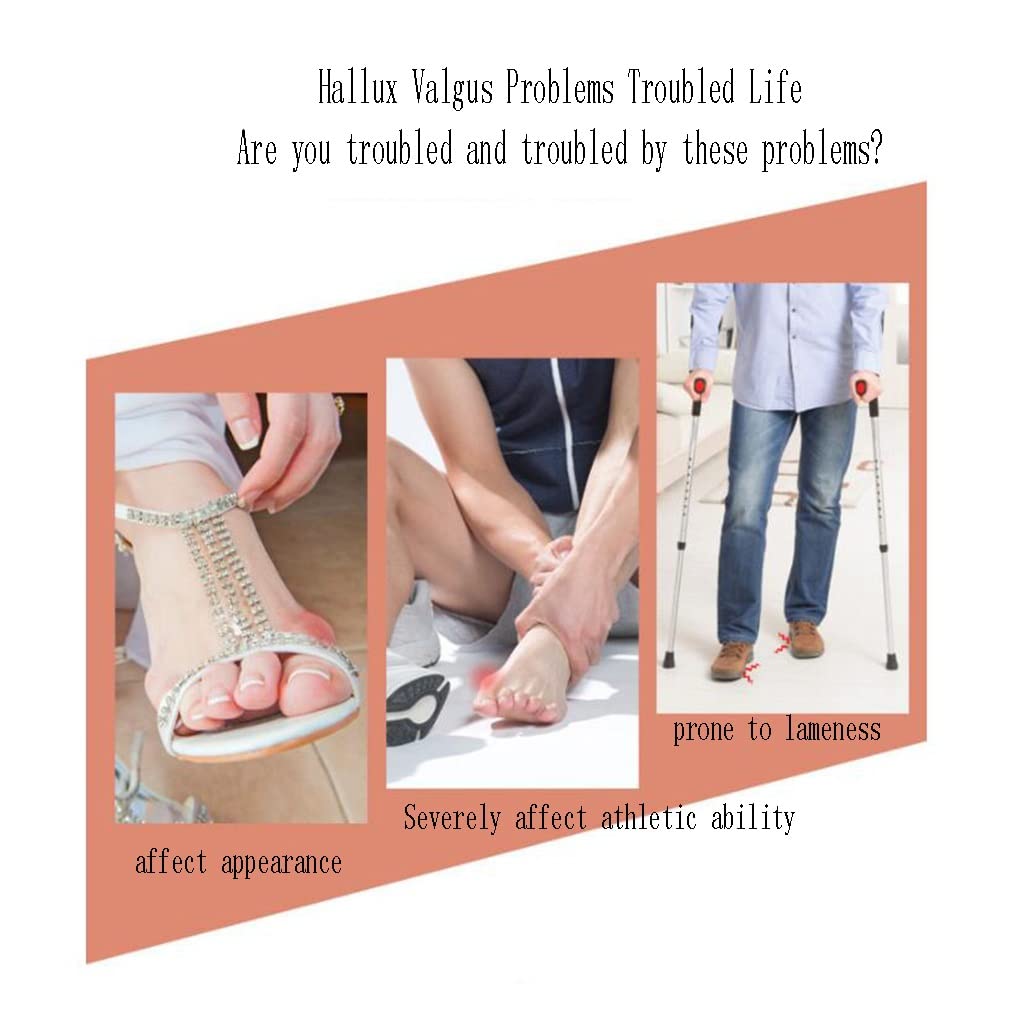 Separatori per Dita sovrapposte, correttore per Piastre per Dita in Gel di Silicone, distanziatori per Dita dei Piedi per Artigli da Sarto dell'alluce valgo e Dita storte