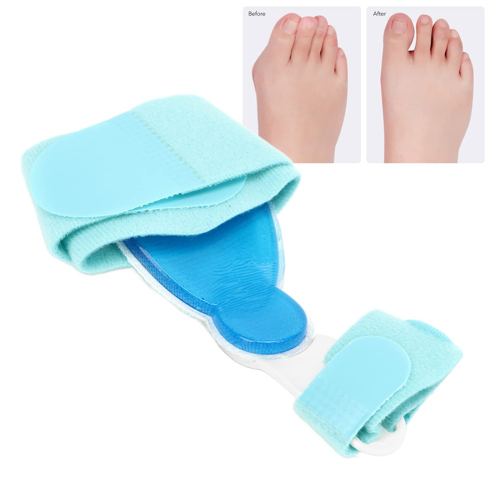Orthopedic Toe Straighteners, Adjustable Bunion Corrector for Overlapping Toes (Lake Blue)
