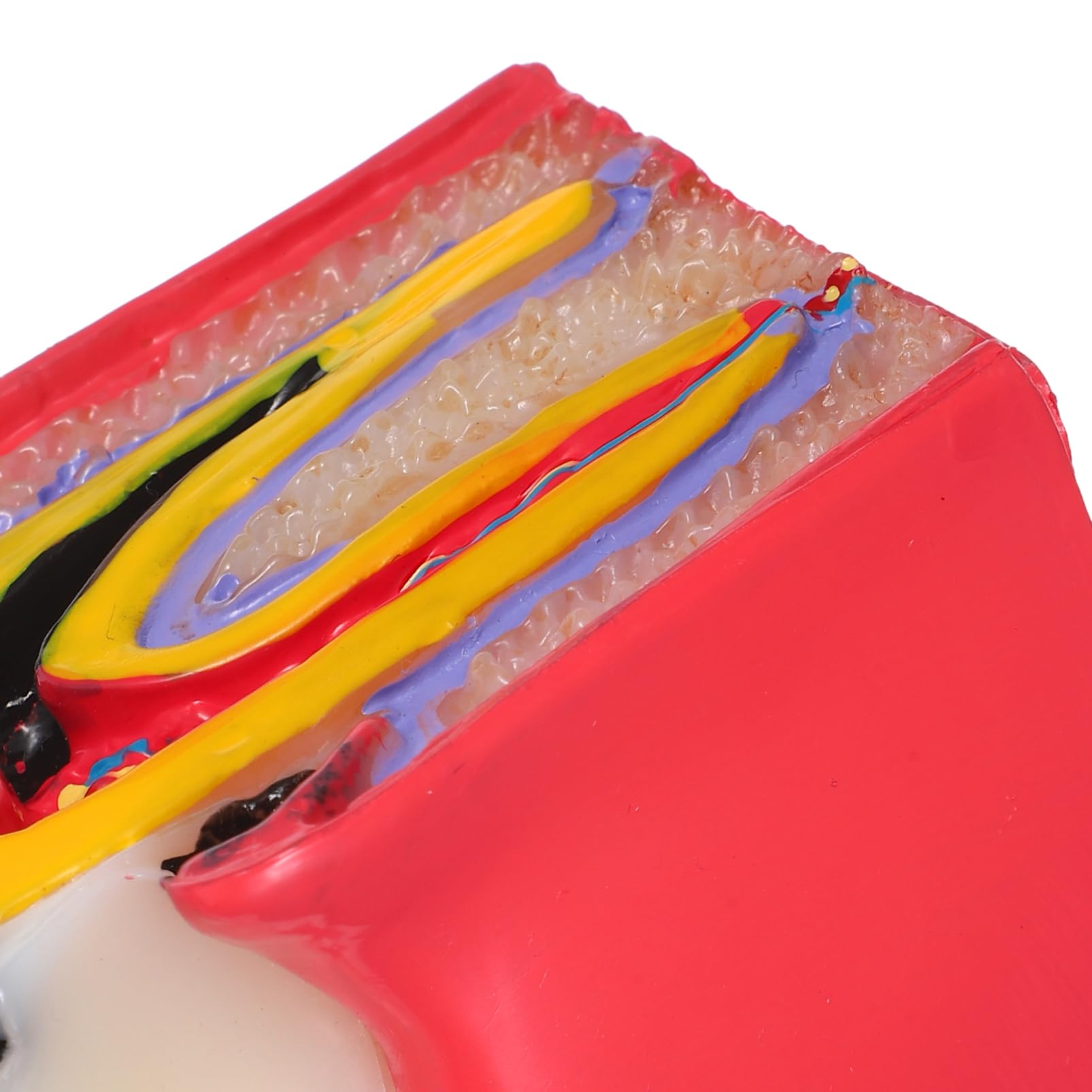 Alipis Modèle D'enseignement Comparatif de Carie Dentaire en Résine pour Dentiste Simulation Précise, Application Polyvalente pour L'éducation à Domicile et Scolaire