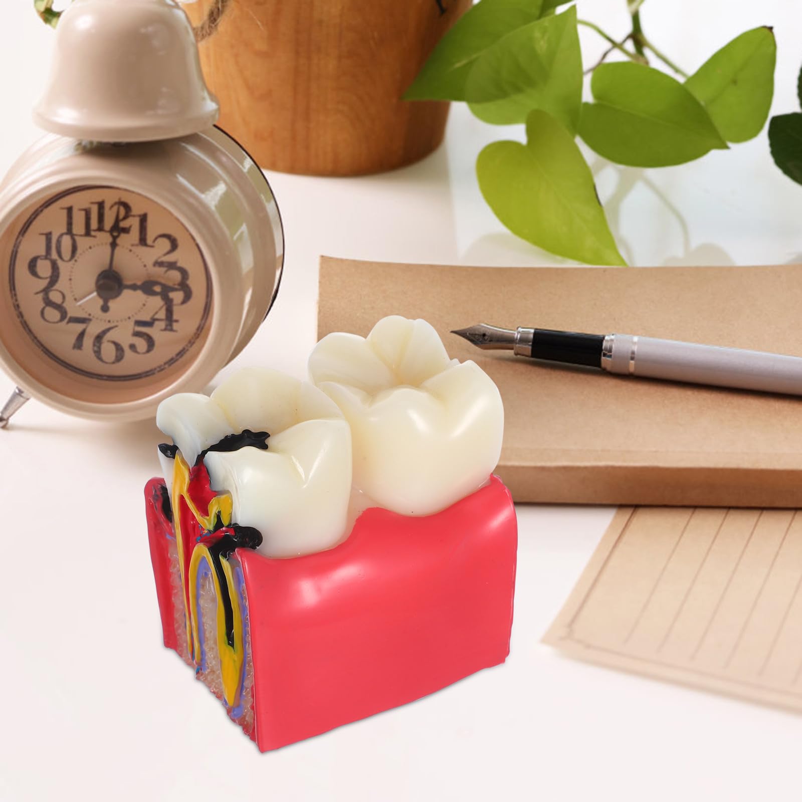 BESTYASH Modèle Pédagogique de Caries Dentaires à 6x Grossissement en Résine, Outil Typodont D'anatomie Comparée Dents Saines Vs Cariées, pour Enseignement en École et Cabinet