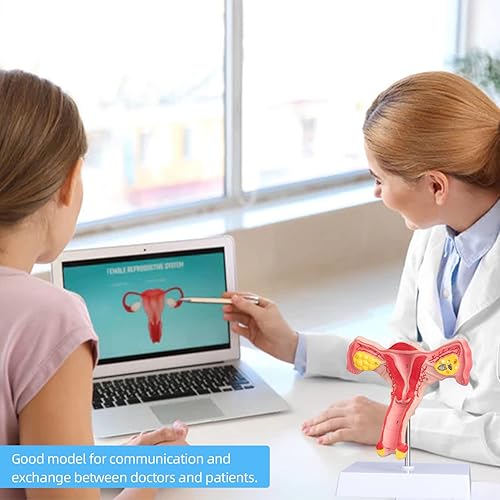 Miniatura 6 de Modelo de útero y ovario humano - Modelo de órgano reproductivo Modelo de ovario de tamaño real