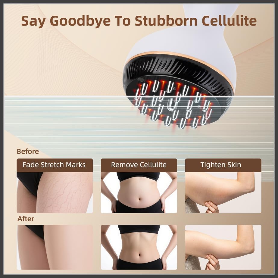 Lymphatic Drainage Massager, Cellulite Massage Tool Helps Reduce Stretch Marks & Cellulite Remover, for Belly, Legs, Arms, 30 Levels Microcurrent, Red Light, Heat and Vibration Body Engraving Machine - Image 2