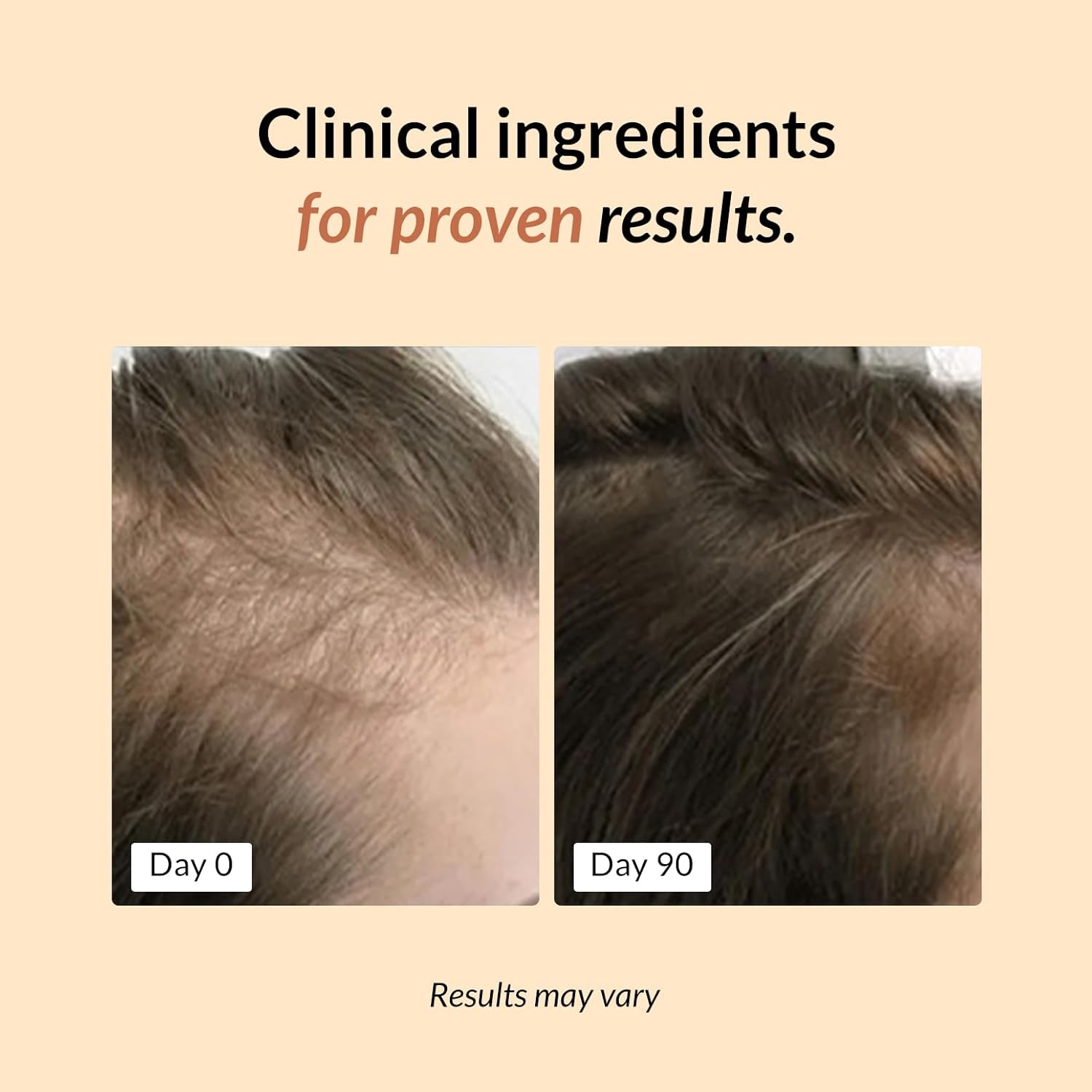 FullyVital Hair Growth Supplement for Women, Ages 35 and Up, Science-Backed Hair Vitamins for Thicker, Fuller Hair with Biotin, Saw Palmetto - Dermatologist Recommended (1 Month Supply, Vegan) - Image 3