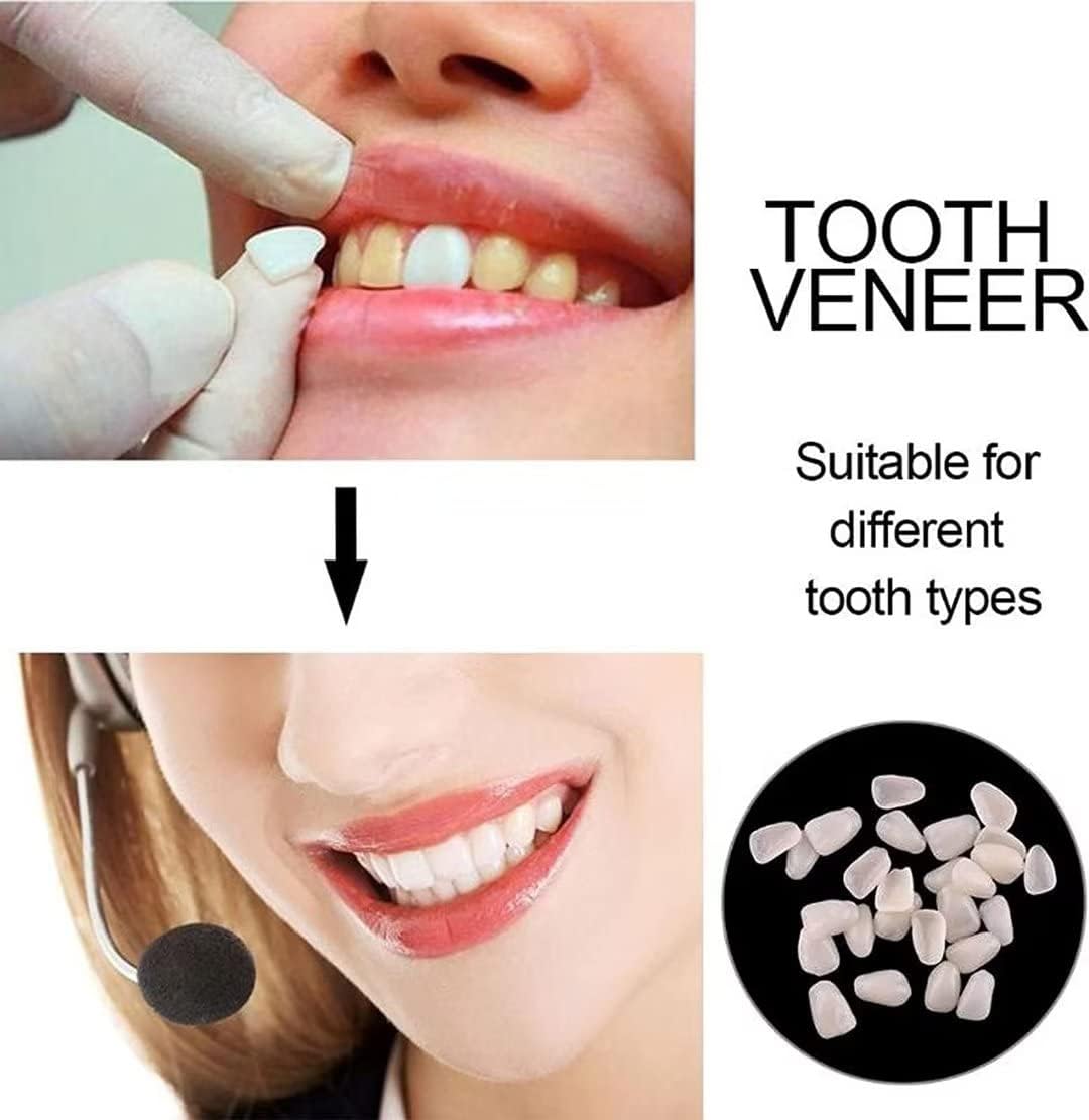 Womcare Kits de réparation temporaire de dents pour le remplissage de la dent cassée manquante et des lacunes, fausses dents malléables et kits de remplacement de perles thermiques