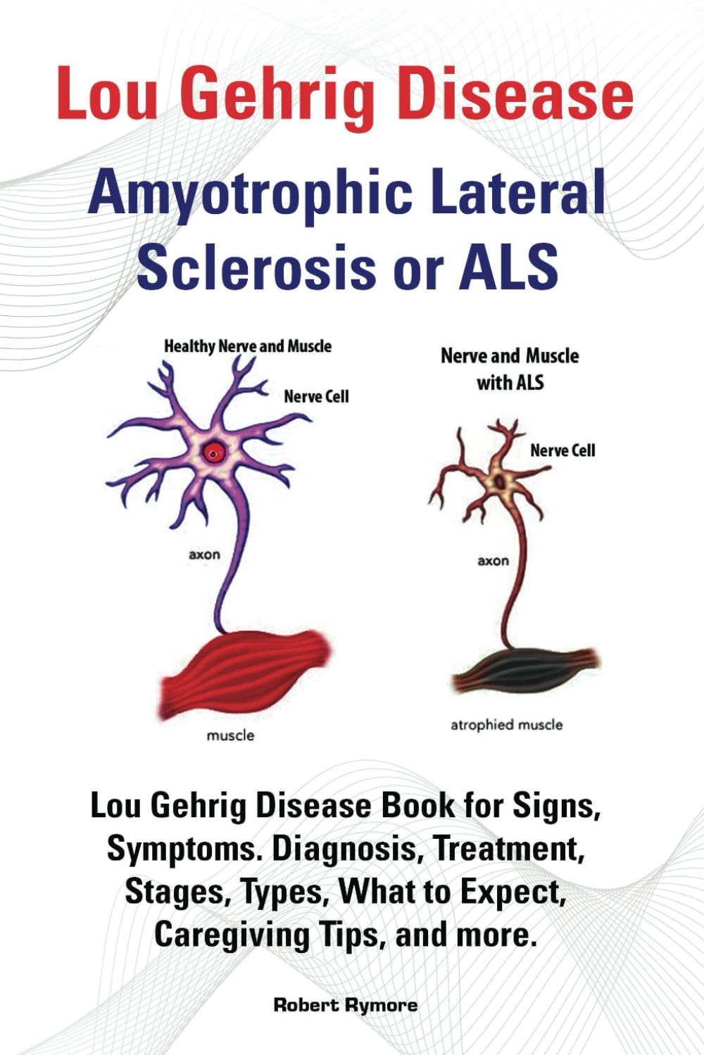 Lou Gehrig Disease, Amyotrophic Lateral Sclerosis or ALS. Lou Gehrig Disease Book for Signs, Symptoms, Diagnosis, Treatment, Stages, Types, What to