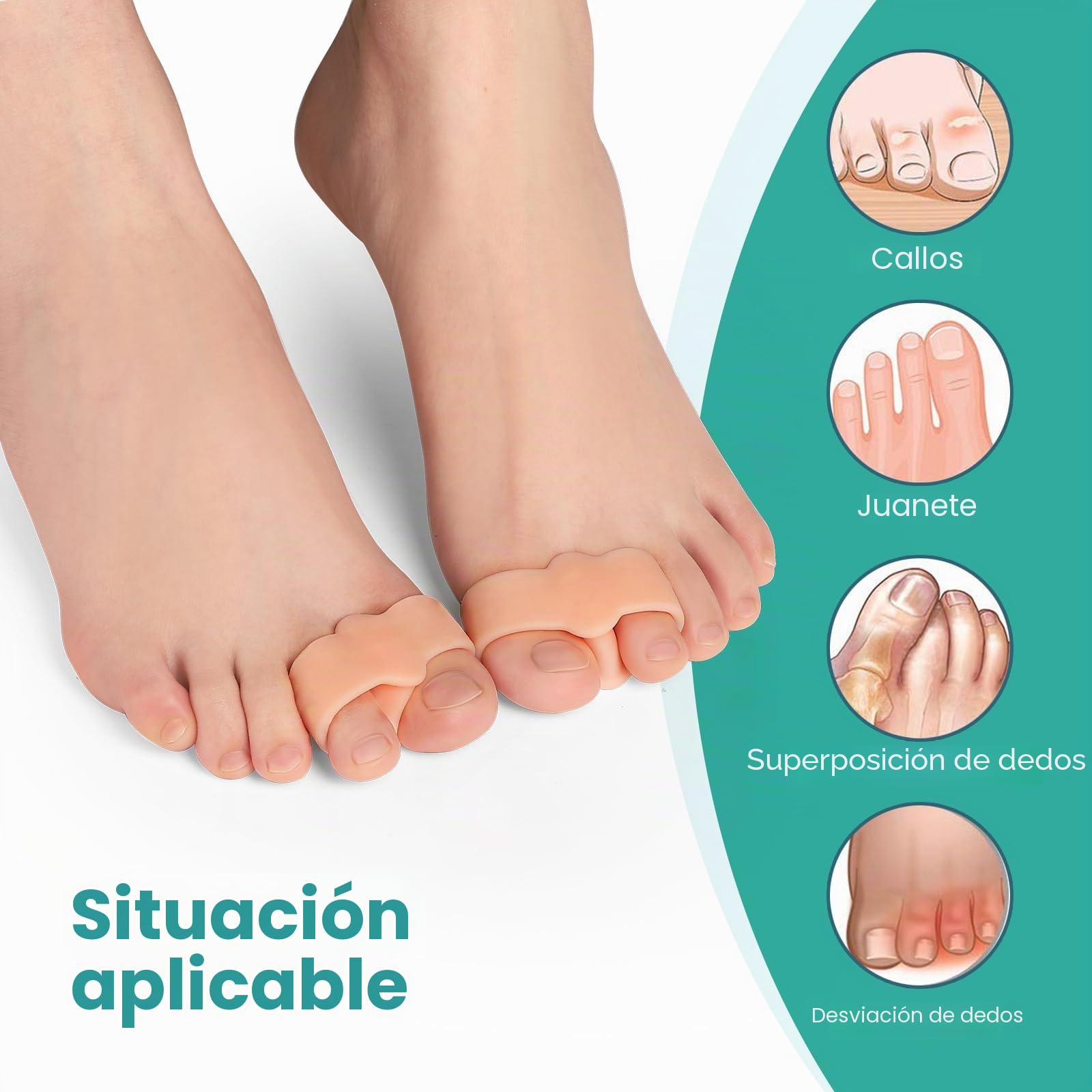 Welnove 12 separadores de dedos con 2 trabillas, separadores de dedos grandes para dedos superpuestos (beige)