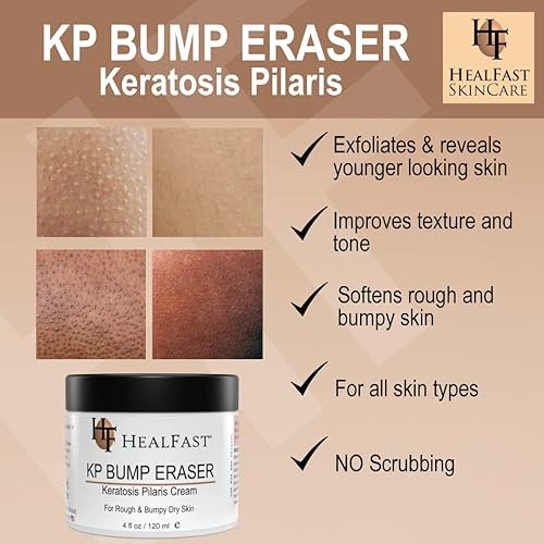 Miniatura 4 de HealFast KP Bump Eraser Body Wash and Cream Set - Suaviza la piel seca áspera y con baches, para todo tipo de piel, tarro de 4 onzas y gel de baño