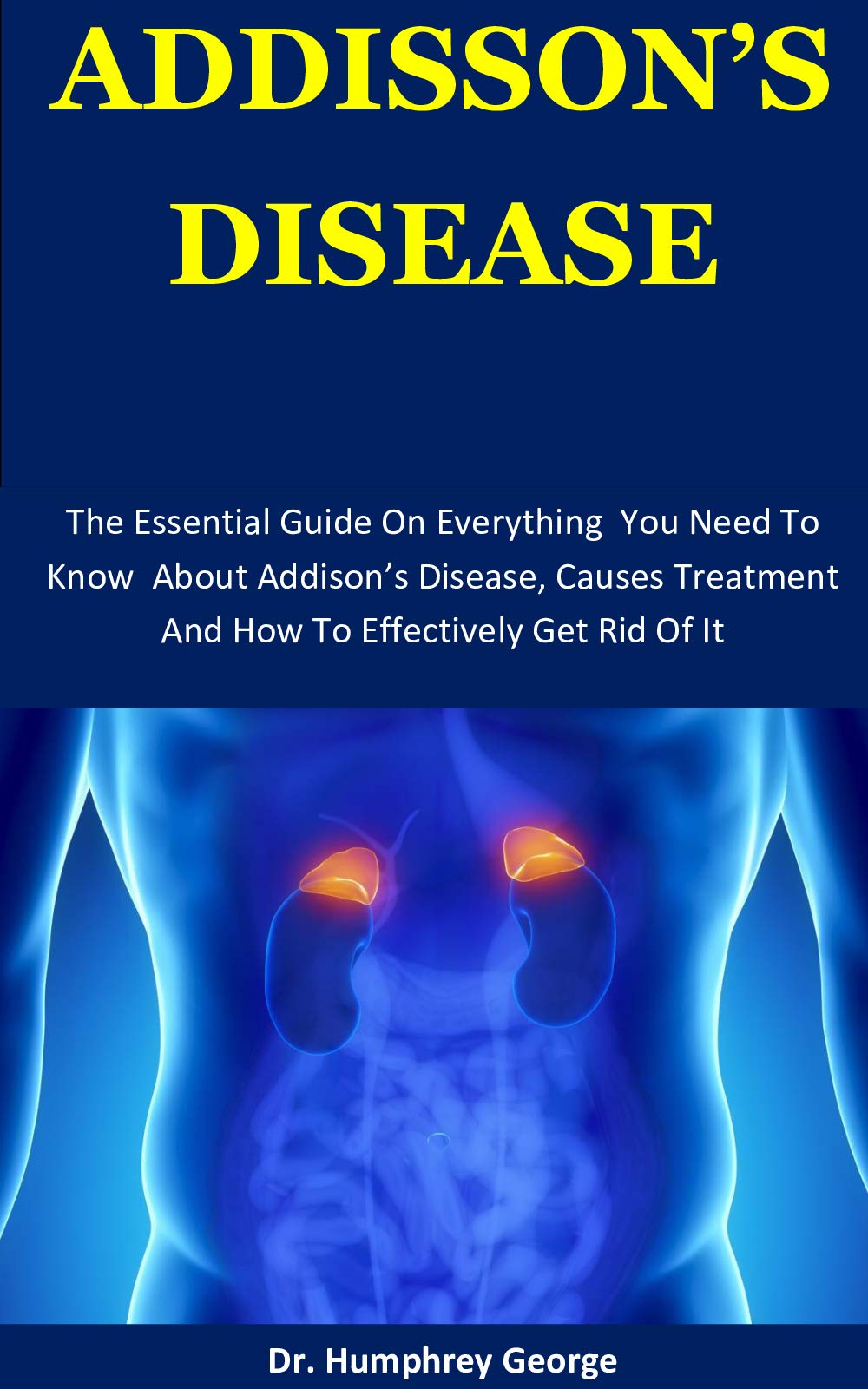 Buy Addison's Disease The Essential Guide On Everything You Need To