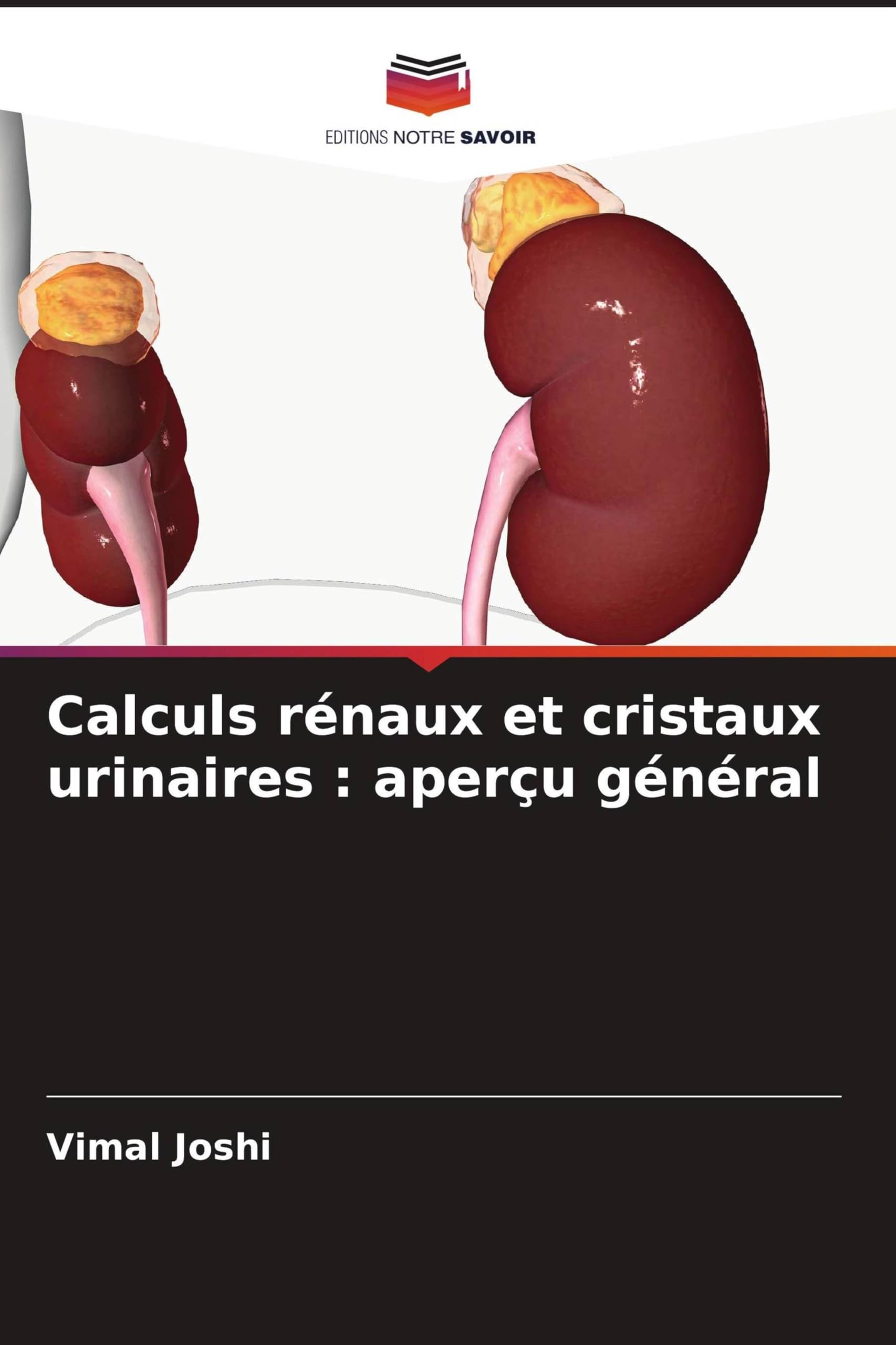 Calculs rénaux et cristaux urinaires: aperçu général