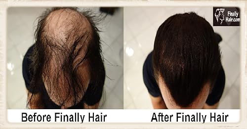 Miniatura 10 de Fibras de cabello Finally Hair en botella, 4.1 onzas Frasco con pulverizador para fijar fibras del cabello, marrón (Light Medium Brown)