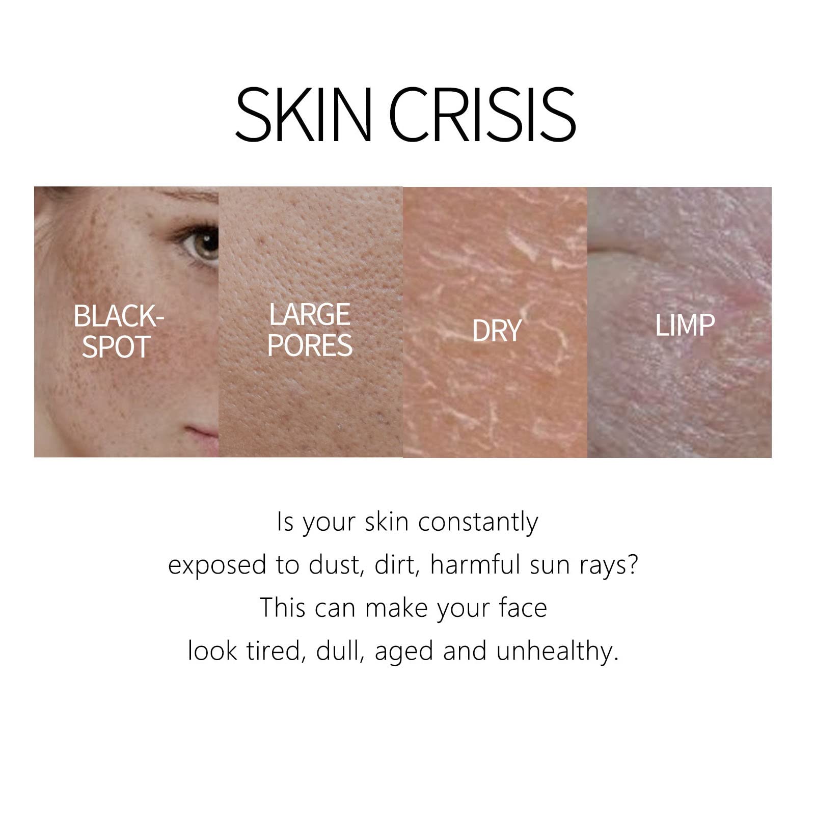 can glutathione remove freckles Glutathione Skin Cream Freckles Removal Cream Remove Lighten Spots Melanin  Moisturizing Skin Care Brightening Face Cream Set : Amazon.co.uk: Beauty