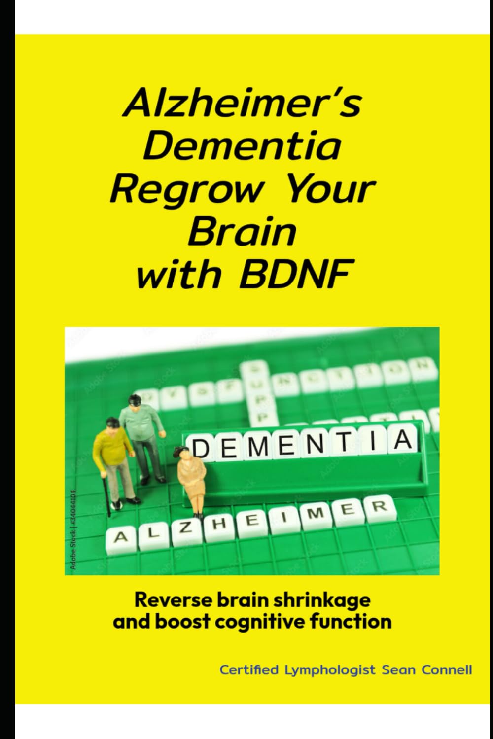 Alzheimer’s Dementia Regrow Your Brain with BDNF: Boost Memory and Reverse Cognitive Decline Naturally