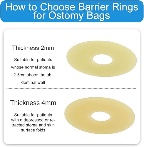 Miniatura 7 de 10 anillos de barrera para ostomía – 0.079 pulgadas de grosor hidrocoloide de grado médico, anillos extensores moldeables para la prevención