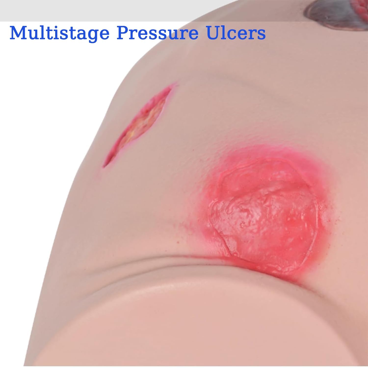 Modèle de soins pour ulcères de pression, simulateur avancé d'escarres pour formation d'évaluation des soins des plaies, simulation d'ulcère en 4 étapes pour l'éducation médicale