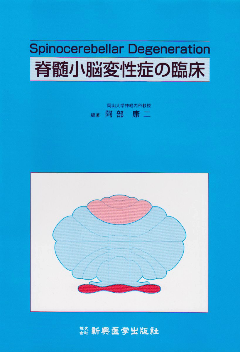 脊髄小脳変性症の臨床 | 阿部 康二 |本 | 通販 | Amazon