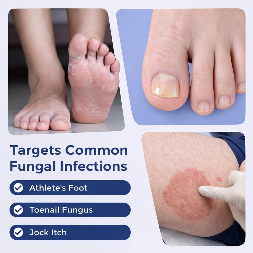 FSA Eligible HSA Extra Strength Athlete‘s Foot & Toenail Fungus Treatment Pen – Maximum OTC Antifungal with 25% Undecylenic Acid, Precision Applicator for Itch Relief & Nail Care