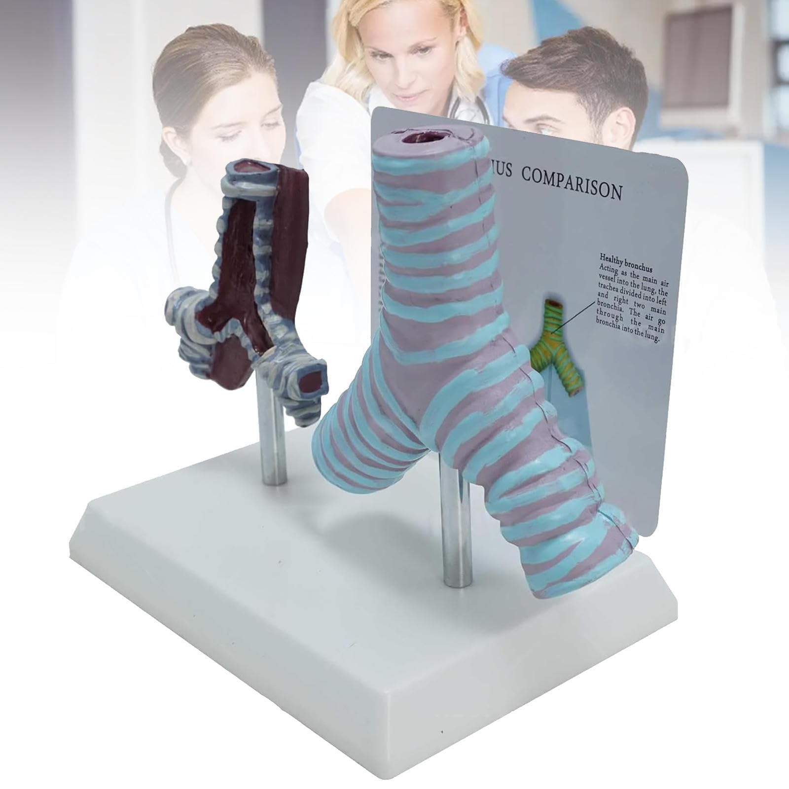 Human bronchi pathological anatomy model, comparative between smokers and healthy for study didactic exposure