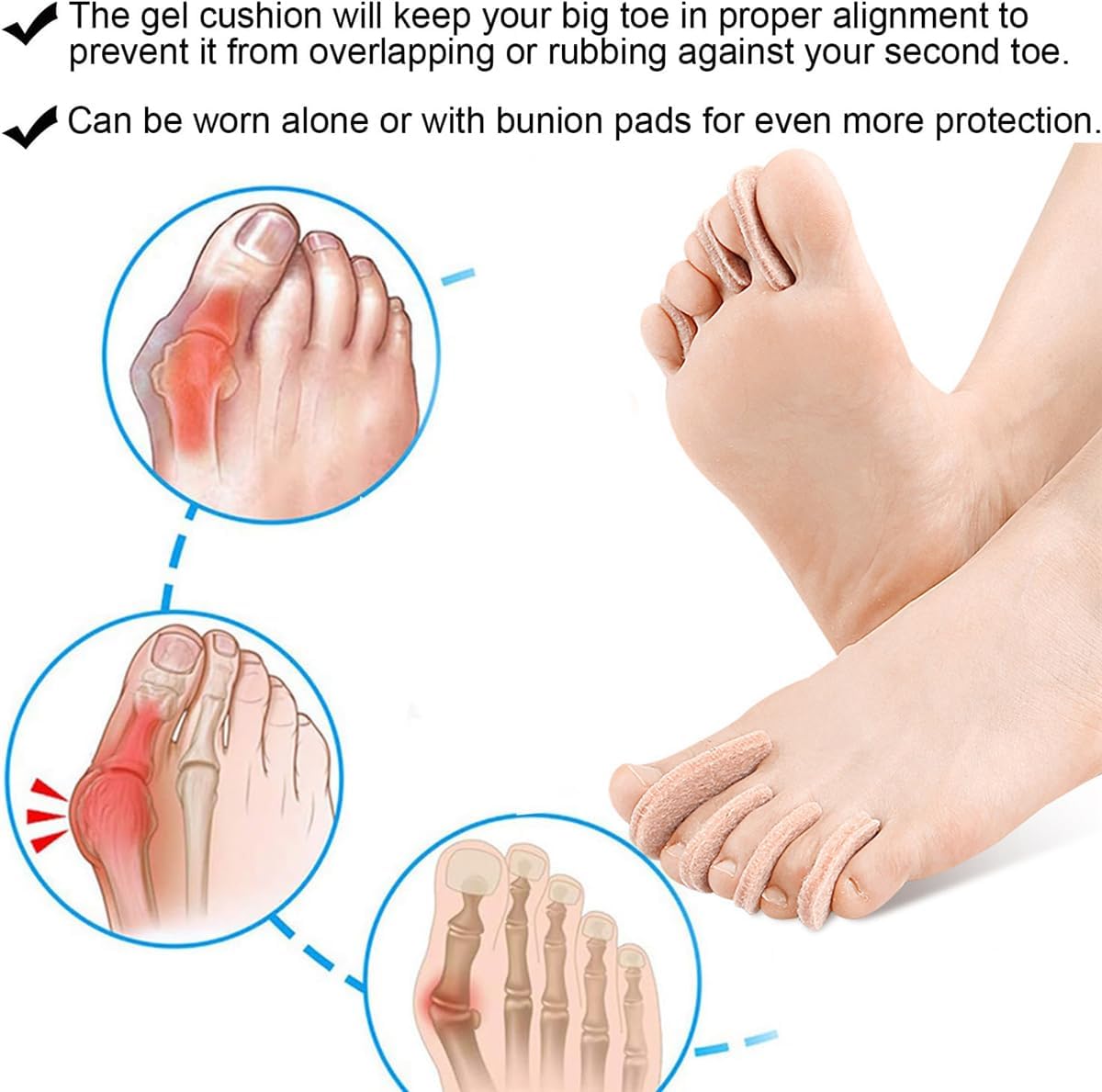 Felt Toe Separators, 20 PCS Bunion Corrector Pads for Women and Men, Pinky Toes Big Toe Spacers, Hammer Toe Straightener Bunion Splint Cushion, for Overlapping Toes, Bunion Pain Relief, Toes Alignment