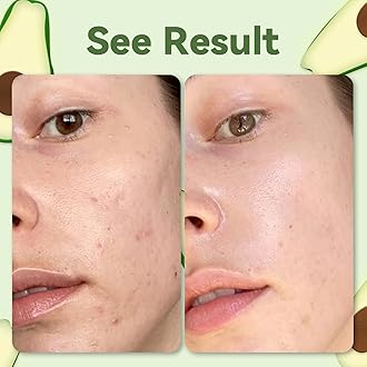 ANAiRUi Avocado Green Tea Clay Mask, Matcha Mud Mask, Hydrating, Moisturizing, Deep Pore Cleansing, Acne Treatment, Detox Spa Facial Mask, Face Masks Beauty, Skin Care, Valentine's Day Gift 120g