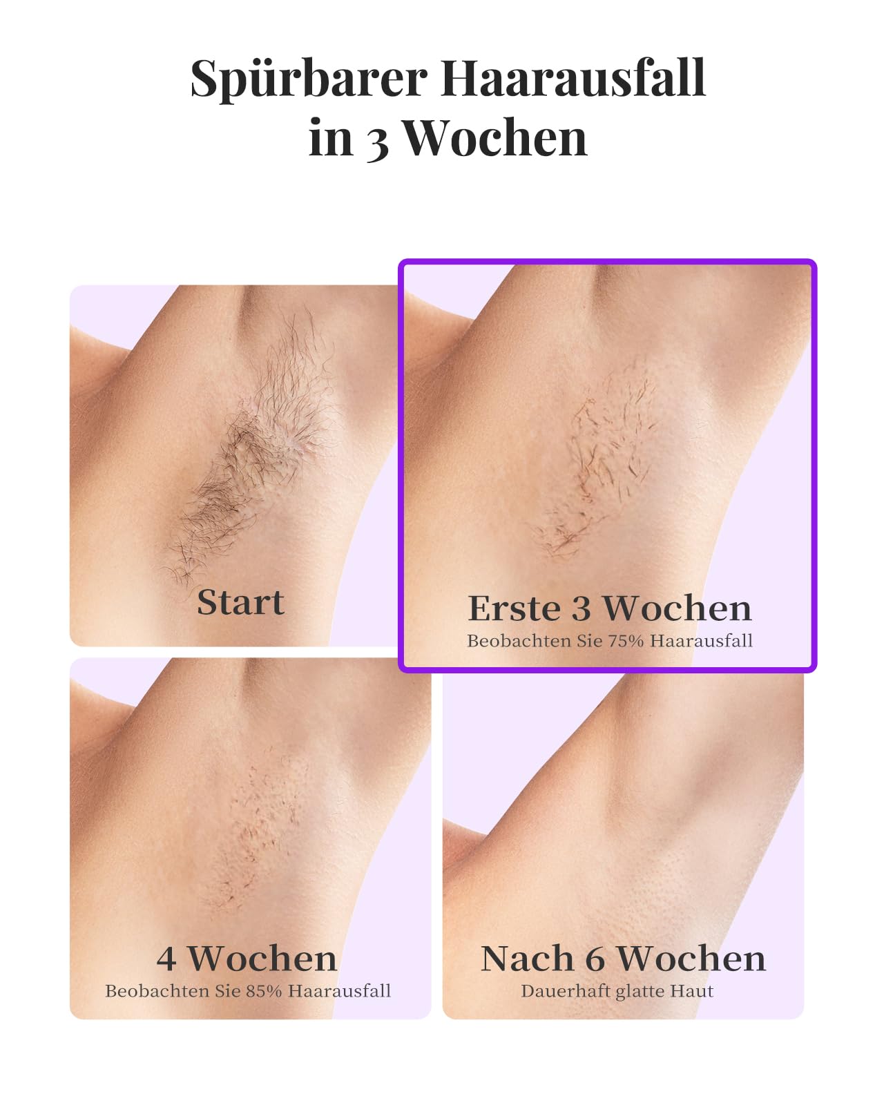 Haarlosy IPL Geräte Haarentfernung Laser mit Gefrierfunktion und Reinigungslicht